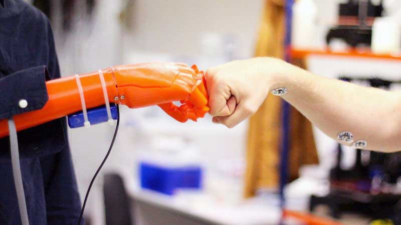 Prosthetic Hands – OPENBIONICS