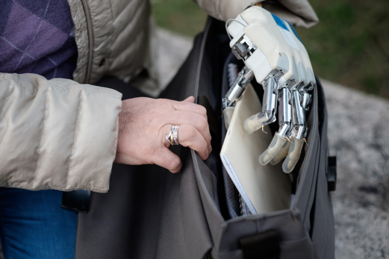 A Prosthetic That Restores The Sense Of Where Your Hand Is Robohub 1861