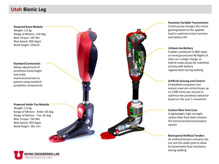 The Utah Bionic Leg A Motorized Prosthetic For Lower limb Amputees 