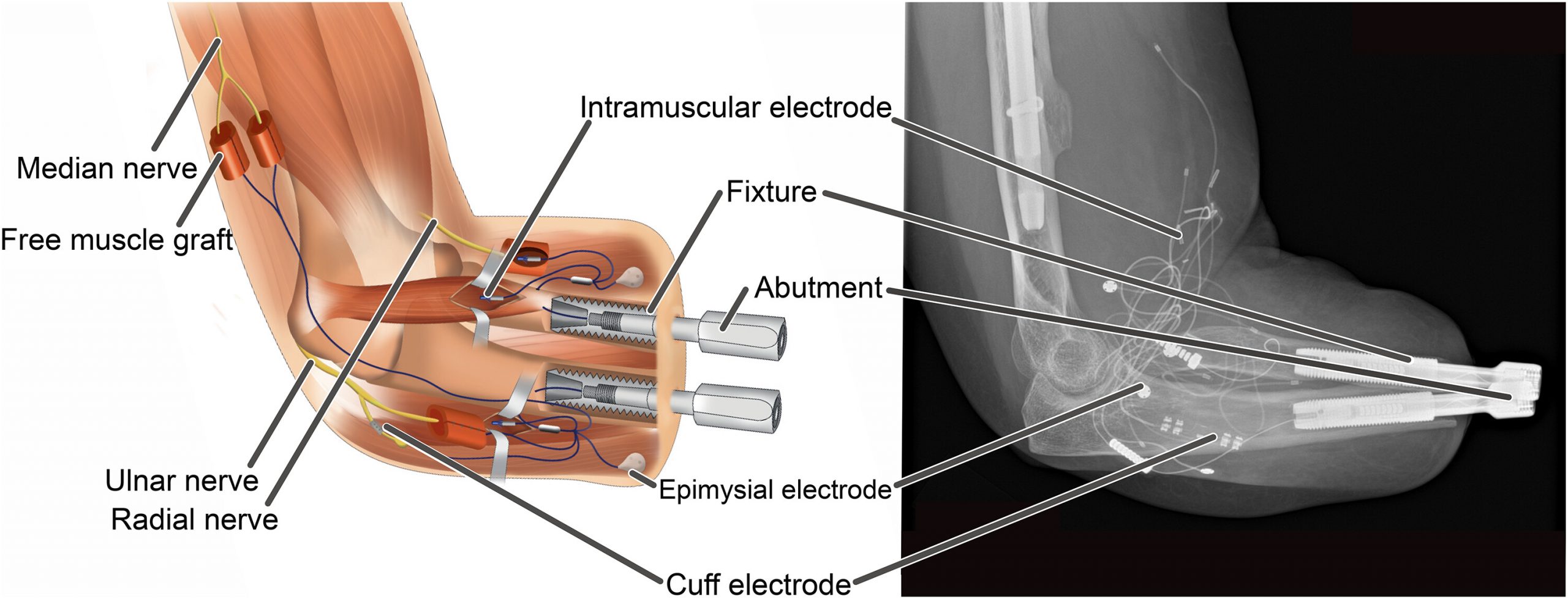 https://robohub.org/wp-content/uploads/2023/10/6image2-scaled.jpg